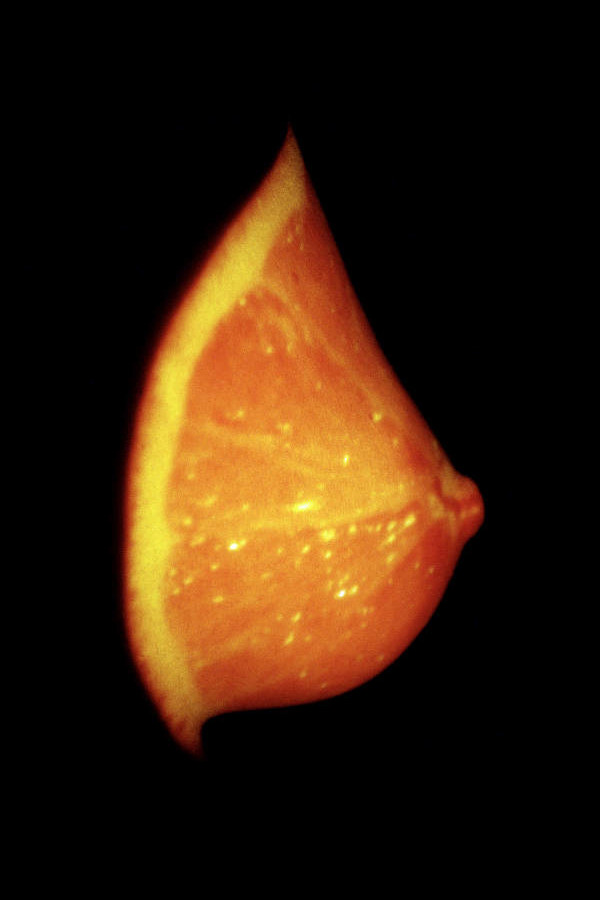 Aktfoto in Farbe - Projektion: Brust Orange
