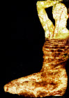 erotikphotos 